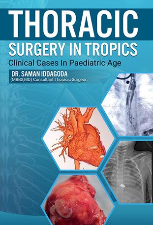 THORACIC SURGERY IN TROPICS CLINICAL CASE IN PAEDIATRIC AGE